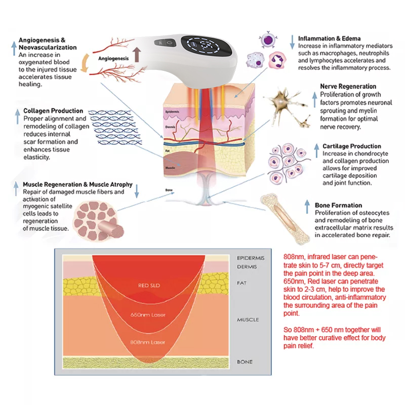 2x808nm Cold Laser Therapy Dev - đánh giá và giá Badminton Bag